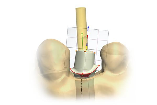 Abutment Design