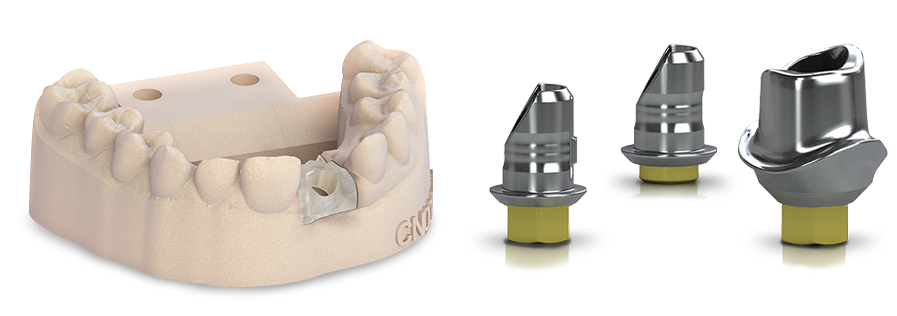 Fusion Custom Ti Abutments